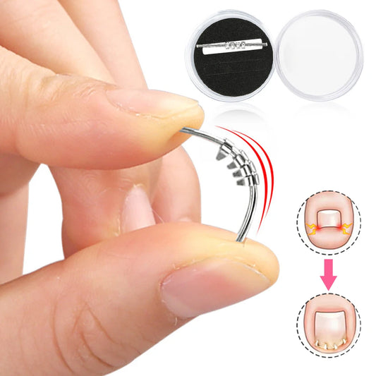 Ingrown Toenail Correction Clip